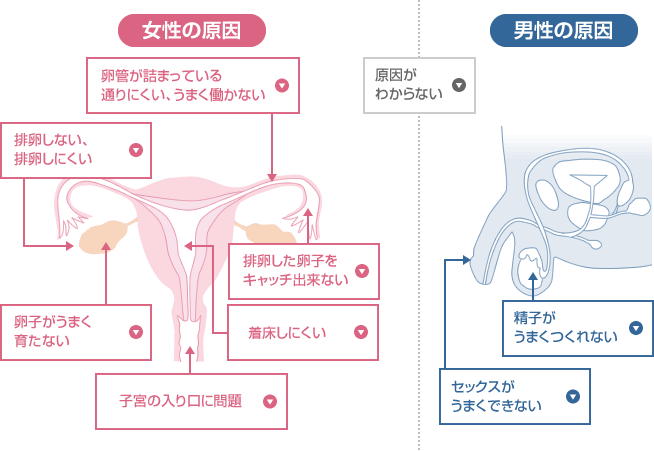 プロセスで見る不妊の原因